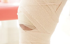 膝関節のテーピング